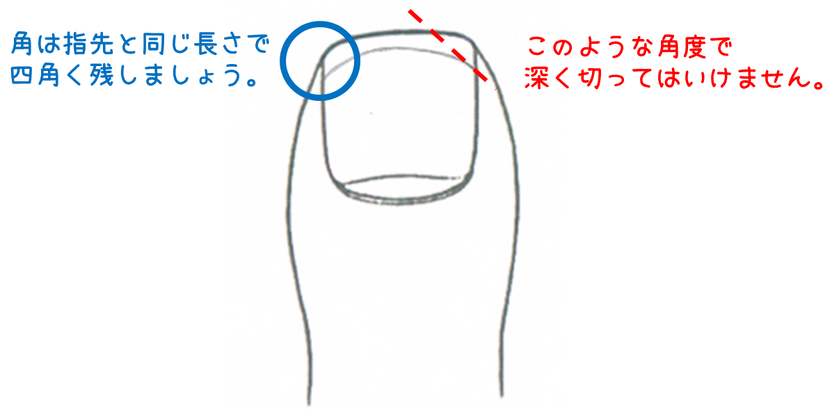 誤った爪の切り方